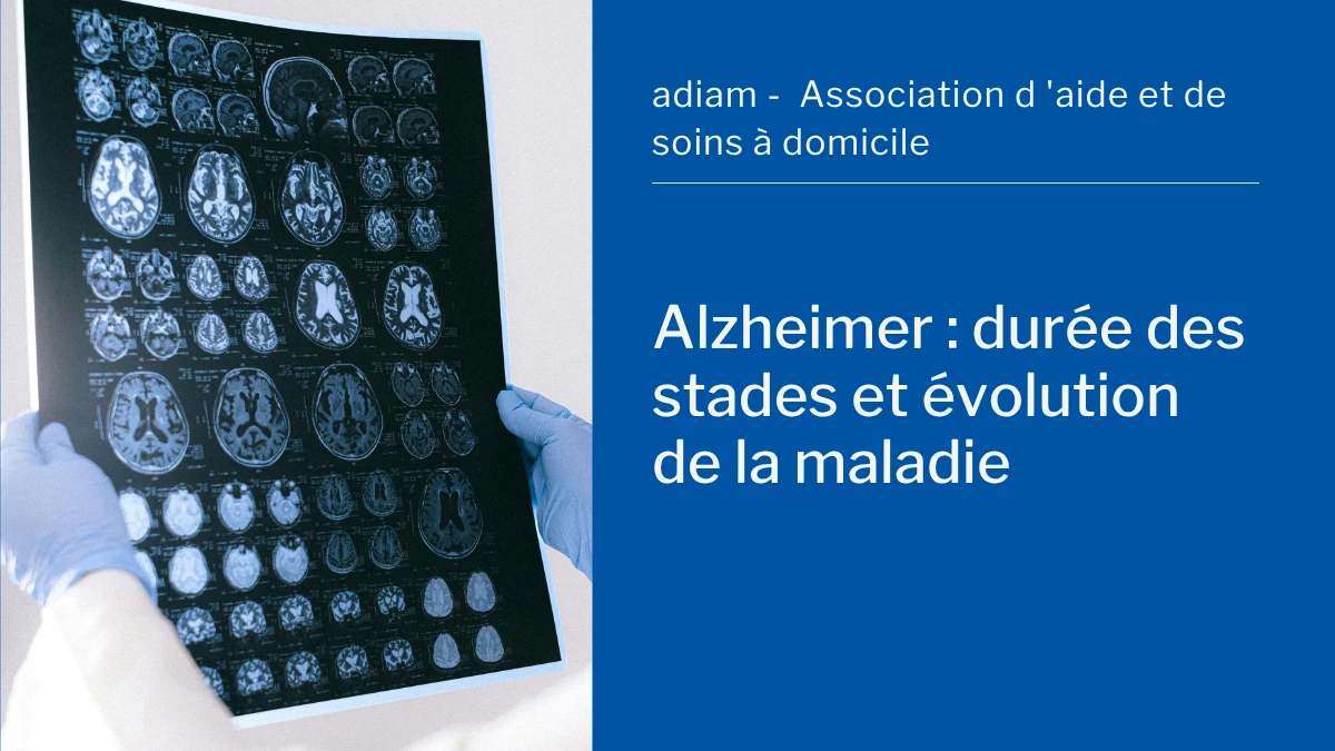 Alzheimer duree des stades maladie